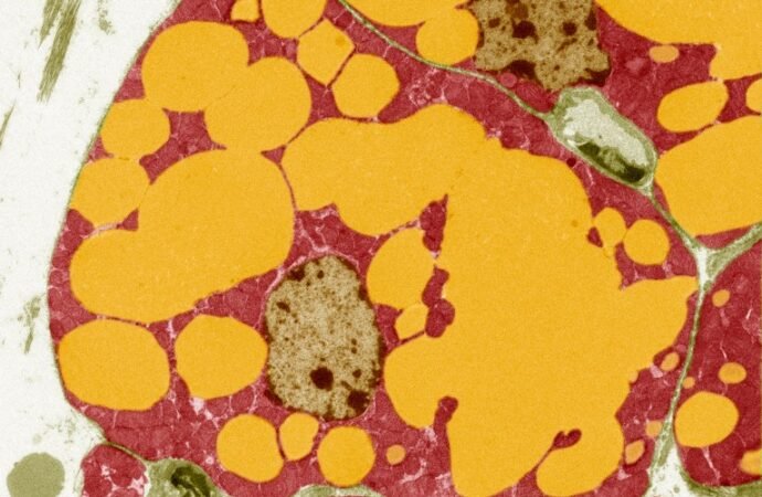 More muscle, less belly fat: mutations to a gene are linked to wide-ranging benefits