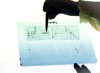 More than 18,000 questionable images found in antibody catalogues of 15 companies
