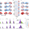 Psychedelics align brain activity with context – Nature