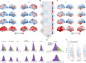 Psychedelics align brain activity with context – Nature