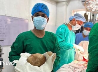 Sri Lanka: Doctors remove 3.1kg stone from man’s bladder