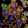 The Moderna cancer vaccine offers hope — now we must speed up personalized therapies
