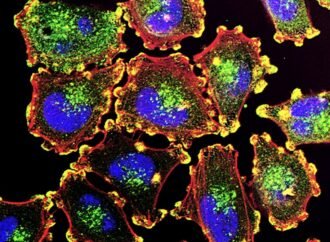 The Moderna cancer vaccine offers hope — now we must speed up personalized therapies