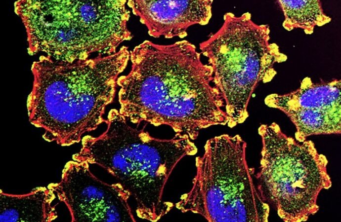 The Moderna cancer vaccine offers hope — now we must speed up personalized therapies