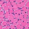 This pulsating muscle graft mimics benefits of exercise