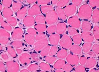This pulsating muscle graft mimics benefits of exercise