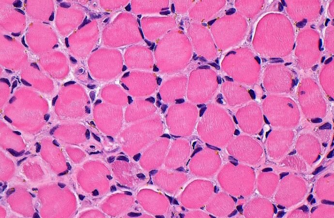 This pulsating muscle graft mimics benefits of exercise
