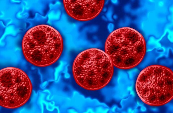 Two people in Michigan have died after becoming ill with cyclosporiasis