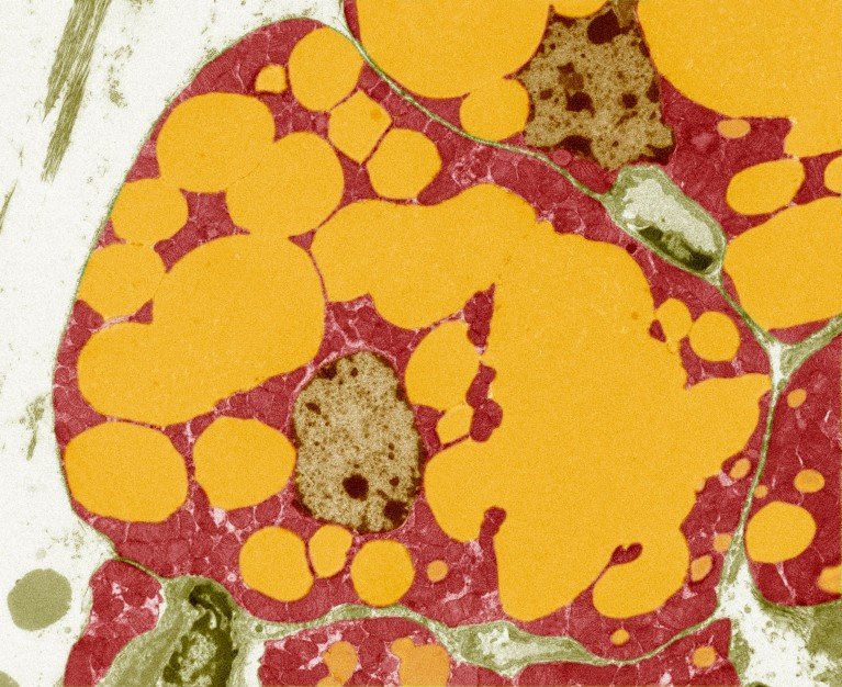 Coloured transmission electron micrograph of a section through adipose fat tissue, showing large yellow fat droplets surrounded by a red layer of cytoplasm.
