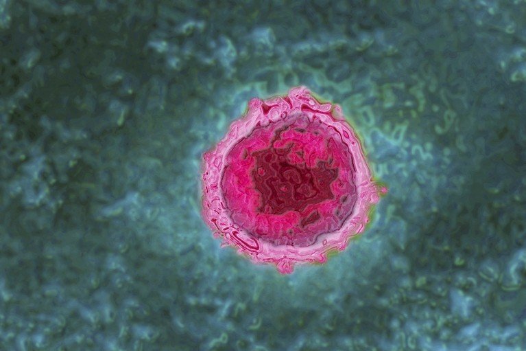 Transmission electron micrograph of the Epstein-Barr virus, exhibiting a rounded, amorphous morphology, highlighted in pink against a green background.