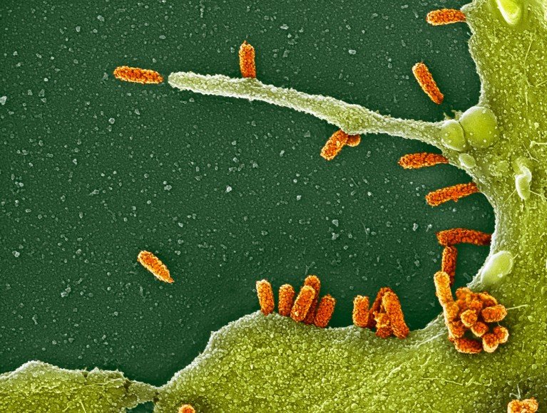 A scanning electron micrograph of orange H1N1 influenza virus particles attached to a green infected lung cell