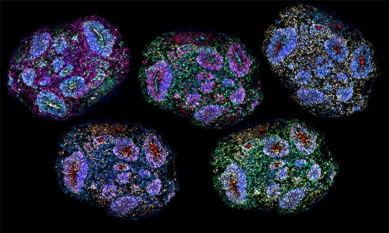 A composite image of five multi-colour sections of organoid tissue on a black background