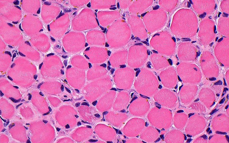 Light micrograph of skeletal muscle cells showing cytoplasm and nuclei.