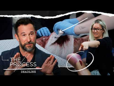 ‘The Pitt’s Noah Wyle & Makeup Department Head Myriam Arougheti On The Practical Effects Behind S2 thumbnail