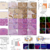 Hepatocytes promote liver metastasis of pancreatic cancer by providing serine – Nature