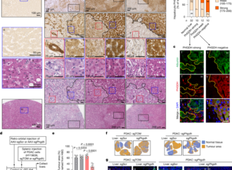 Hepatocytes promote liver metastasis of pancreatic cancer by providing serine – Nature