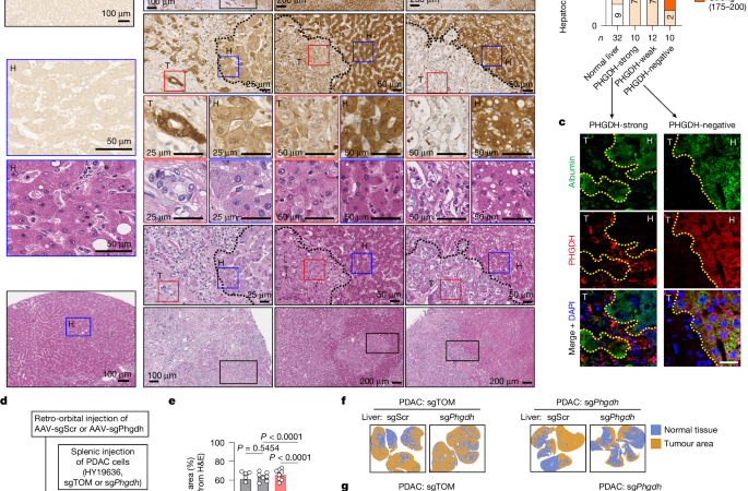 Hepatocytes promote liver metastasis of pancreatic cancer by providing serine – Nature