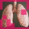 How a team of AIs discovered a promising lung-cancer drug