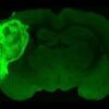 Human brain cells transplanted into mice in ‘most extensive’ integration ever