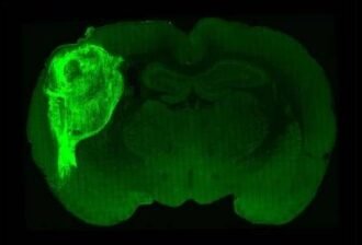 Human brain cells transplanted into mice in ‘most extensive’ integration ever