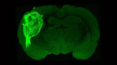 Human brain cells transplanted into mice in ‘most extensive’ integration ever