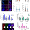 MMEJ repair of breaks at TA repeats maintains ecDNA and cancer fitness – Nature