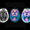Map of brain ‘microproteins’ could offer new clues to Alzheimer’s disease