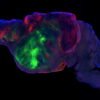 Mice with human brain cells offer a tool to study disease. Ethicists ask: What’s next?