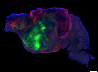 Mice with human brain cells offer a tool to study disease. Ethicists ask: What’s next?