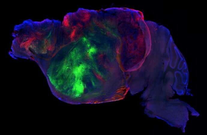 Mice with human brain cells offer a tool to study disease. Ethicists ask: What’s next?