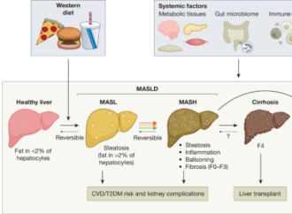 Molecular mechanisms and pathogenesis of MASH – Nature