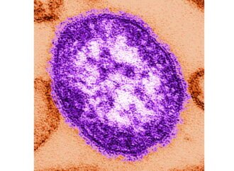 Pennsylvania says an unvaccinated woman has died from measles-related complications