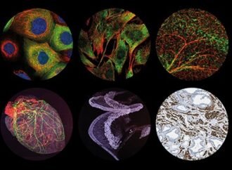 Probing the proteome at cellular scale