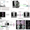 Rapid patient-specific neural networks for X-ray to volume registration – Nature