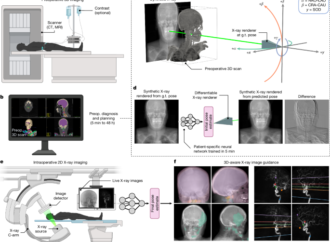 Rapid patient-specific neural networks for X-ray to volume registration – Nature