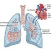 Risks of Decompression Sickness and Venous Thromboembolism during Spaceflight and Patent Foramen Ovale Implications – NASA