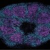 Scientists map key protein interactions linked with profound autism