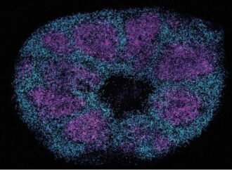 Scientists map key protein interactions linked with profound autism