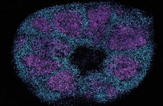 Scientists map key protein interactions linked with profound autism