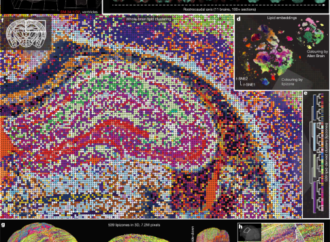 The lipidomic architecture of the mouse brain – Nature