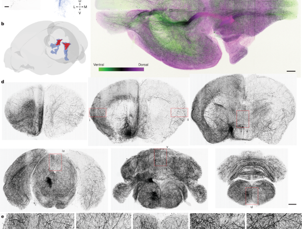Topographic structure and function of locus coeruleus noradrenaline neurons – Nature
