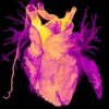 Transplanted hearts adjust their biological age to that of their host