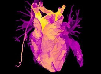Transplanted hearts adjust their biological age to that of their host