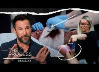 What makes ‘The Pitt’ so horrifyingly realistic? We asked the show’s makeup and prosthetic pros.