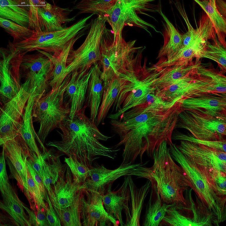 Fluorescent microscope image showing a network of fibroblasts