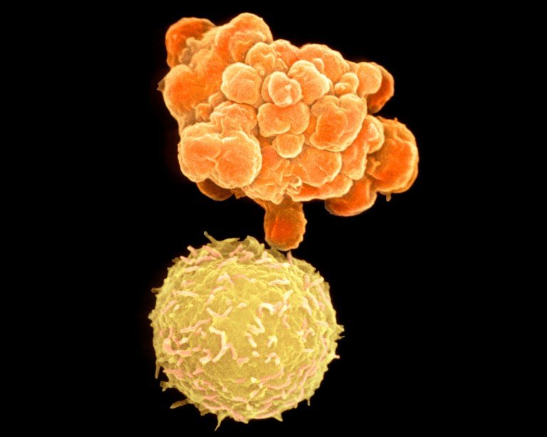 Scanning electron micrograph of two cells; the one above has many blobby protrusions and the other is roughly spherical..