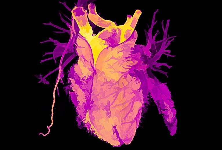 A brightly coloured 3D CT scan of a healthy heart.