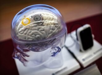 ‘Multifunctional’ brain implant translates speech and gestures in real time