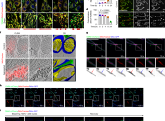 GRP75-dependent SIMPA mediates inter-organellar quality control – Nature