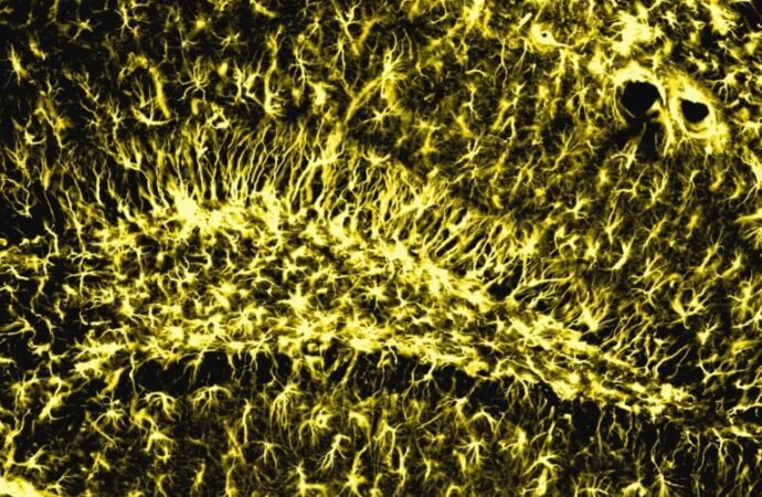 Memory stays strong in old age when this brain enzyme is active